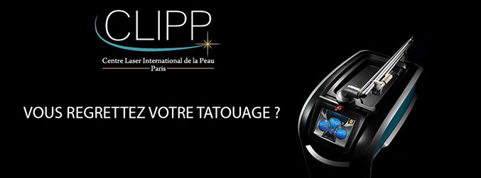 laser revolutionnaire detatouage picosure blog