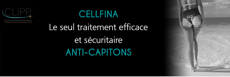 Traitement anti-cellulite CELLFINA: pour lisser durablement les capitons, au CLIPP à Paris.