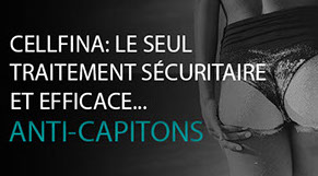 Melasma ou masque de grossesse: comment les traiter au laser à Paris.