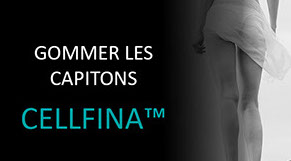 Cellfina au CLIPP à Paris: un centre d'excellence pour lisser les capitons liés à la cellulite.