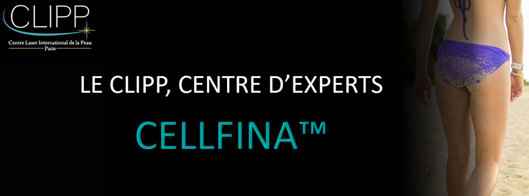 Cellfina™: enfin un traitement efficace de la cellulite au CLIPP à Paris.
