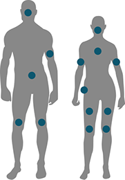 Zone traitées avec le CELLFINA, le THERMAGE et l'EXILIS.