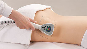 femme exilis btl&nbsp; centre laser clipp paris 2