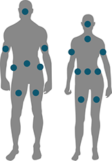 zones corps exilis btl centre laser clipp paris