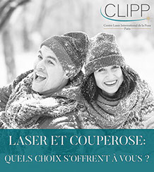 Traiter la couperose au laser: les choix possibles pour éradiquer la couperose au CLIPP-Paris.