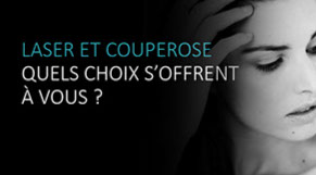 Varicosités des jambes: origines et solutions.