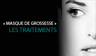 Melasma ou masque de grossesse: comment les traiter au laser à Paris.