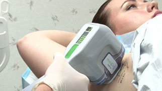 femme miradry techniques centre laser clipp paris