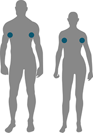 ZONES TRAITÉES AVEC L'APPAREIL MIRADRY