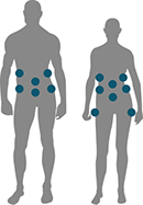 sculpsure tarif paris laser clipp