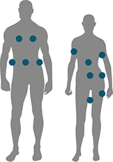 zones corps cryolipolyse zeltiq centre laser clipp paris