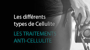 Retrouver confort intime à la ménopause avec le laser Mona Lisa.