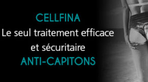 Contre la cellulite et les capitons: le traitement CELLFINA au CLIPP à Paris.