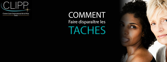 Effacer les taches brunes ou de soleil au laser 