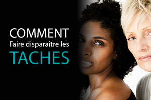 Cryolipolyse: le Cool Mini pour gommer le double -menton sans chirurgie au CLIPP à Paris.