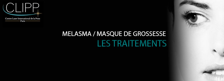 Enlever un masque de grossesse ou melasma au laser à paris.