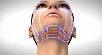 Les ultrasons Ulthera® au Clipp à Paris, pour rajeunir visiblement.